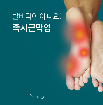 토마스정형외과 족저근막염