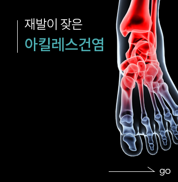 토마스정형외과 아킬레스건